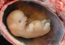 Mengapa aborsi itu dosa