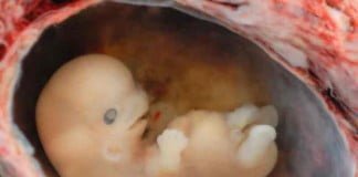 Mengapa aborsi itu dosa